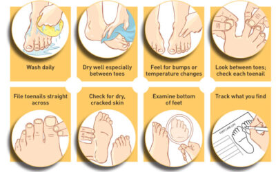 Foot care for people with Diabetes