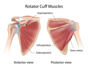 Rotator Cuff Injuries